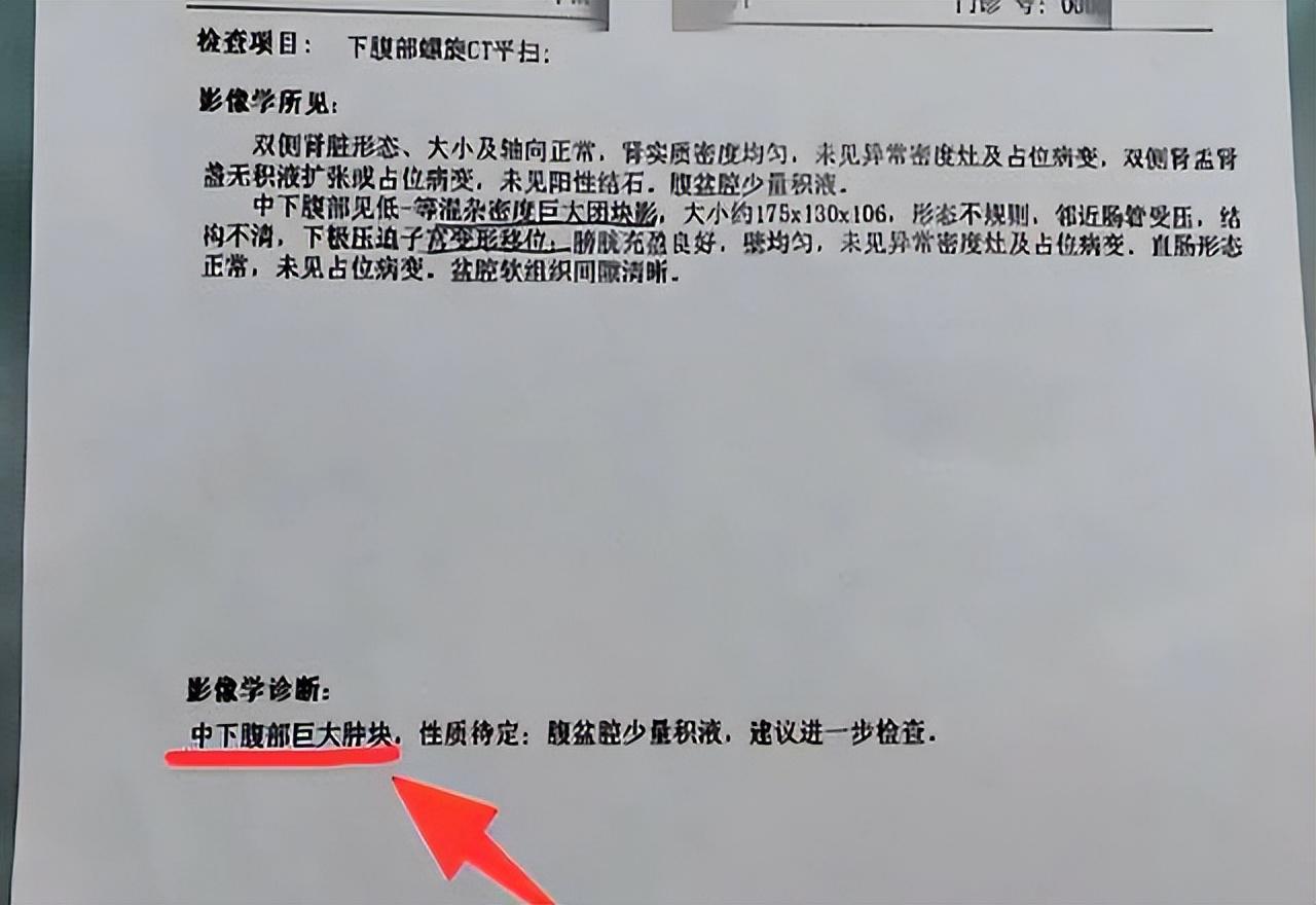 体检报告出现这3个“字眼”,多半是肺癌前兆!建议立刻就医